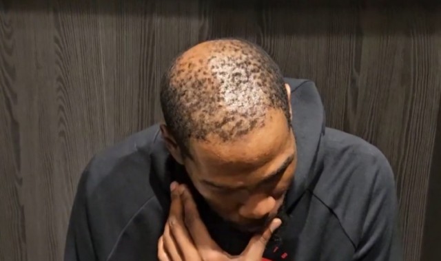 彩经网官网app下载-37岁还单身有原因😳！杜兰特秃顶这么严重 这发量找对象难啊